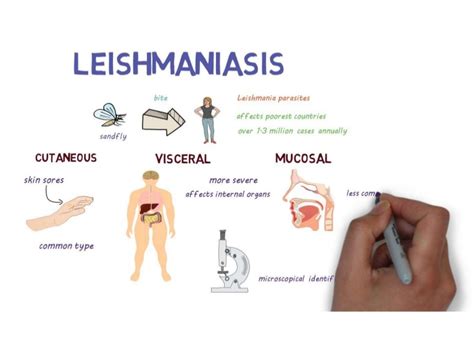 Leishmaniasis: Visceral (kala-azar), Cutaneous, Lupoid and Mucocutaneous - Online Biology Notes