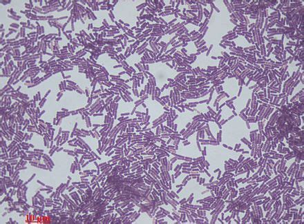 Bacillus subtilis gram stain in 2024 | Bacillus, Microbiology, Bacillus subtilis