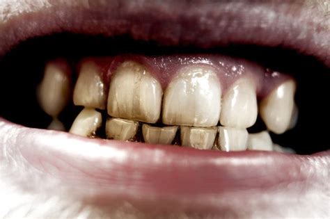 Really Gross Facts About Your Teeth | ThatViralFeed