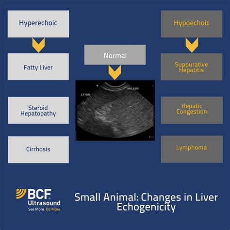 Echogenic Ultrasound