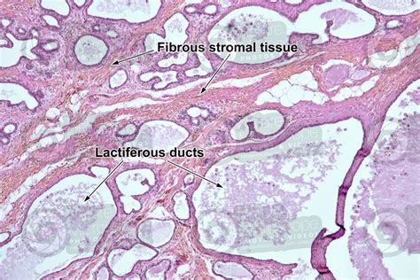 Woman. Active mammary gland. Vertical section. 64X - Mammary gland - Mammals - Integumentary ...