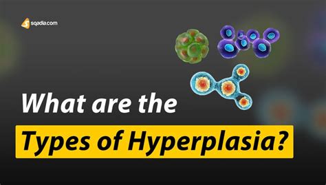 What are the types of Hyperplasia? | Physiology Animation