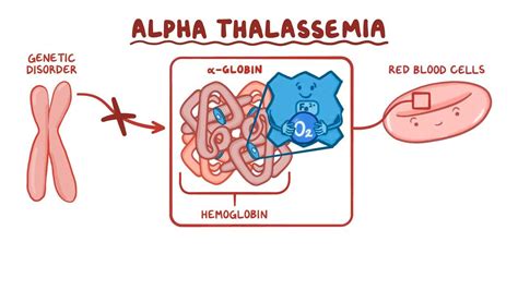 Alpha-thalassemia: Video, Anatomy & Definition | Osmosis