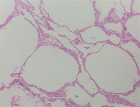 Simple Squamous Epithelium our protective tissue magnified | Histology slides, Exam, How to ...