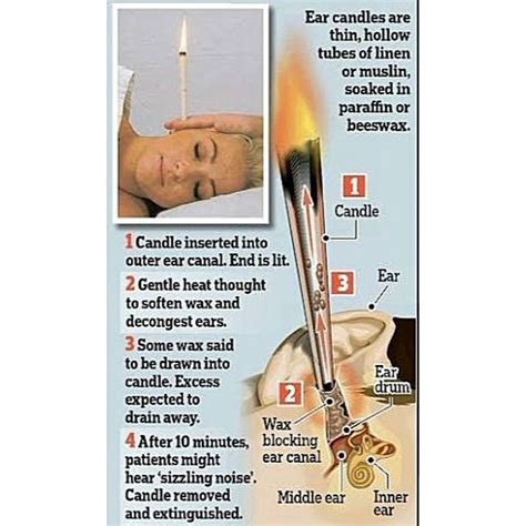 Where To Get Ear Wax Candle - Image ... #EarWaxBlockage | Ear candling, Candle ear wax, Candle ...