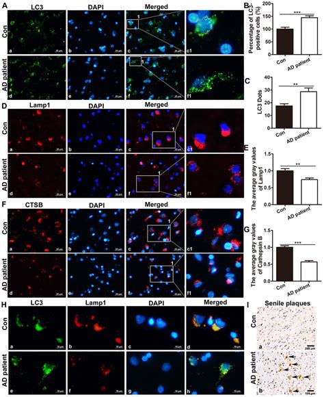 Dynamic changes of autophagic flux induced by Abeta in the brain of postmortem Alzheimer’s ...