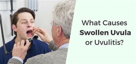 Swollen Uvula (Uvulitis): Causes, Symptoms & Natural Treatments