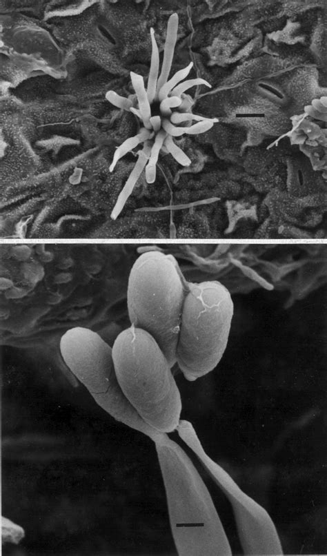 SEM of Colletotrichum gloeosporioides on Euphorbia hirta, IMI 345359.... | Download Scientific ...