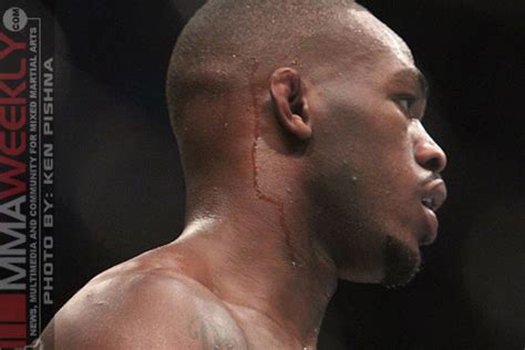 Jon "Bones" Jones Explains the Injury That Kept Him Out of His Fight ...