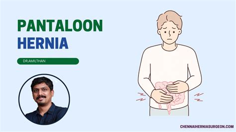 Pantaloon Hernia - chennaiherniasurgeon.com