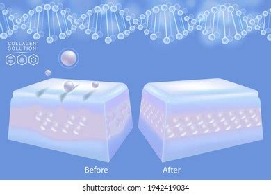 Hyaluronic Acid Before After Skin Solutions Stock Vector (Royalty Free) 1942419034 | Shutterstock