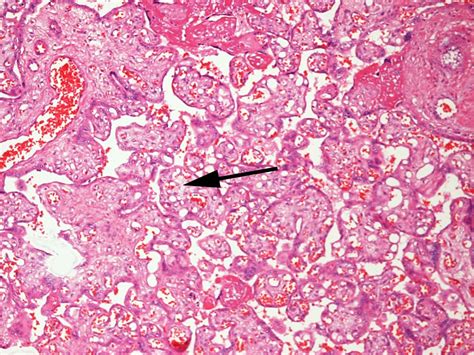 File:Placenta histology 005.jpg - Embryology