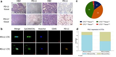 PD-L1 expression on tumors and CTCs. a The typical manifestation of ...