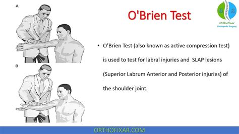 O'Brien Test | Active Compression Test | OrthoFixar 2024