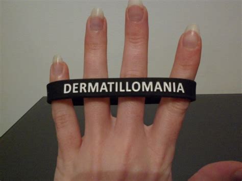 Dermatillomania | Skin Picking Face | Pinterest