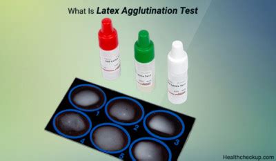 Latex Agglutination Test: Procedure, Principle,Types, Results Interpretation