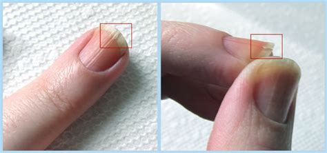 nails splitting down the middle - pictures, photos