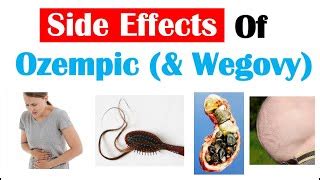 Ozempic (u0026 Wegovy) Side Effects | How They Work Wha... | Doovi