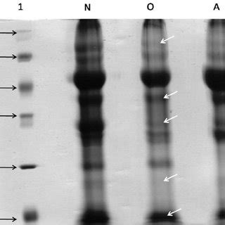 Differential expression of Concanavalin A binding proteins in human ...