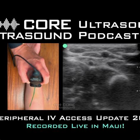 The PENG Block with Highland EM – Core Ultrasound