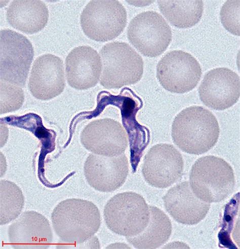 What is the Difference Between Leishmania and Trypanosoma | Compare the Difference Between ...