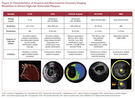 Vulnerable Plaque and Acute Coronary Syndrome | USC Journal