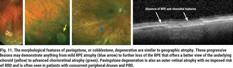 Navigating the Retinal Periphery