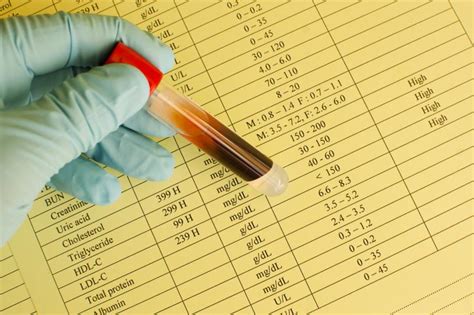 Serum LDL & Cholesterol Levels | LIVESTRONG.COM