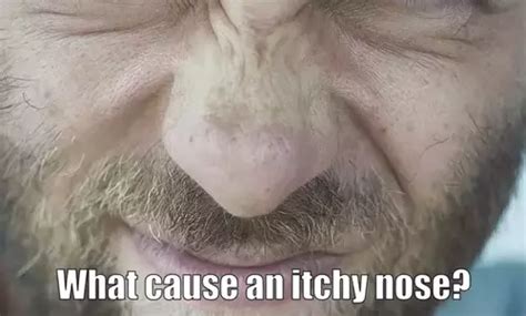 Itchy Nose - A little thing that's Annoying - Health Advisor