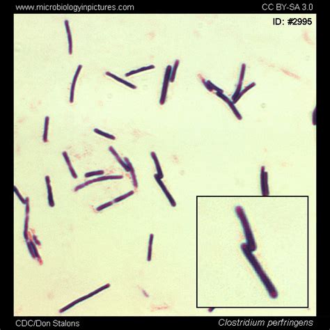 Clostridium perfringens Gram-stain and cell morphology. Clostridium perfringens micrograph ...