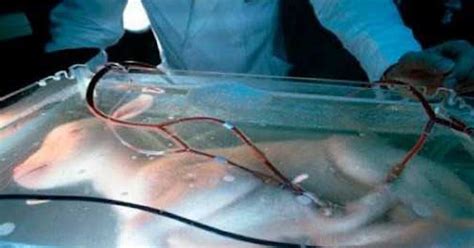 NNN / 1996 - First Artificial Womb Experimented