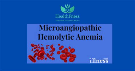 Microangiopathic Hemolytic Anemia: Symptoms, Causes, And Treatment2024 ...