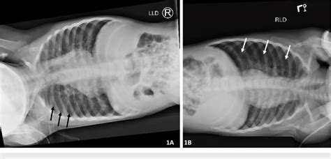 Lateral Decubitus Abdomen