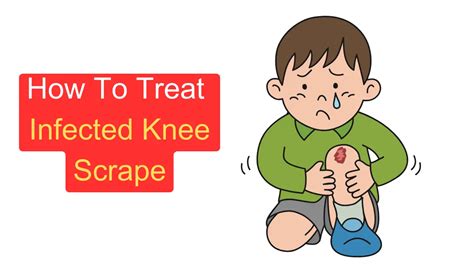 How To Treat Infected Knee Scrape - MyHealthGeek