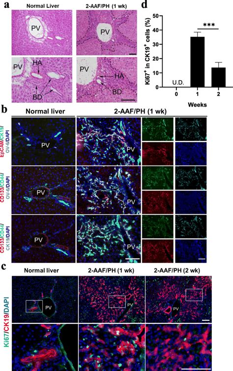 Hepatic stem/progenitor cells are induced following liver injury. a ...