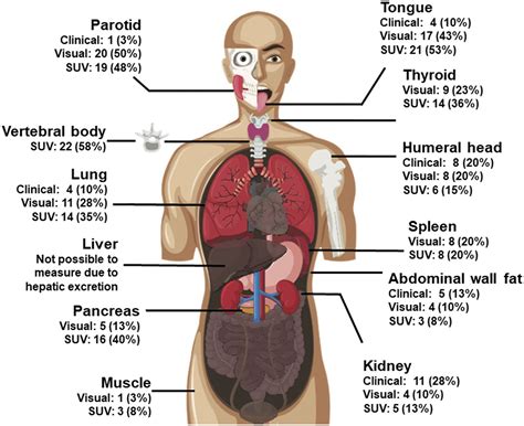 Early Detection of Multiorgan Light-Chain Amyloidosis by Whole-Body 18F-Florbetapir PET/CT ...