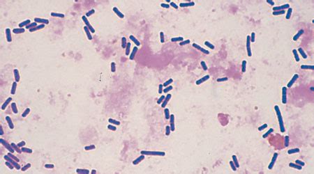 Clostridium Perfringens Gram Stain