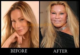 Famous for Plastic Surgery: Jocelyn Wildenstein Plastic Surgery ...