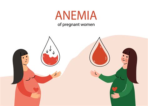 Anemia concept. Pregnant woman suffering from anemia. Low hemoglobin ...