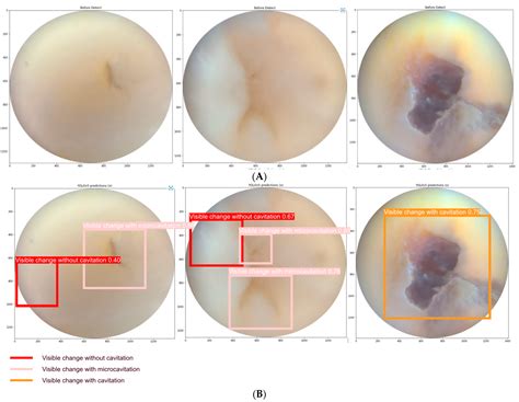 Oral | Free Full-Text | One-Stage Methods of Computer Vision Object Detection to Classify ...