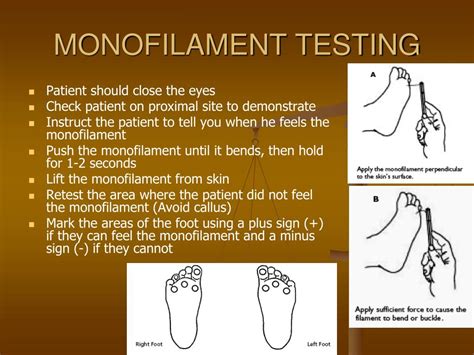 PPT - DM - FOOT EVALUATION IN THE PRIMARY CARE SETTING PowerPoint ...