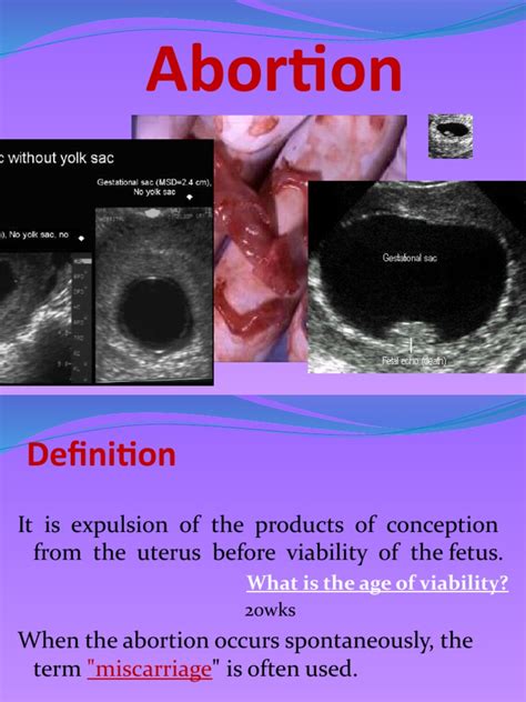 An In-Depth Review of Abortion: Types, Causes, Mechanisms and Clinical ...