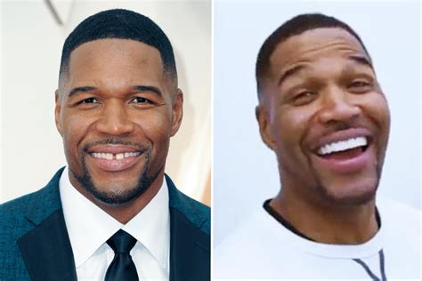 Michael Strahan Teeth 2024 - Josy Rozina