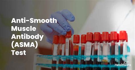 Anti-Smooth Muscle Antibody (ASMA) Test - HEALTHIANS BLOG