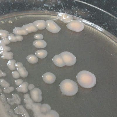 Enterobacter Cloacae Gram Stain