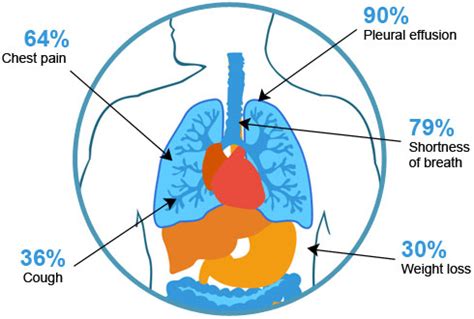 Common Mesothelioma Symptoms