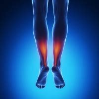 What to Expect During Achilles Tendon Surgery Recovery