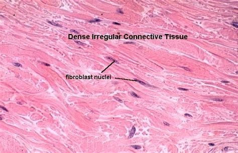 Fibroblasts in dense irregular connective tissue | Collagen fibers, Anatomy and physiology ...