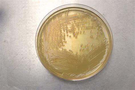 Salmonella enterica | Microchem Laboratory