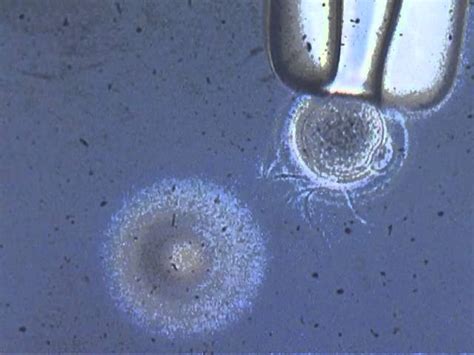 Sperm Egg Microscope